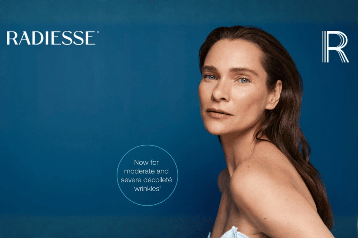 Radiesse collagen biostimulator treatment improving skin firmness and wrinkles on the décolleté area